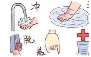 不小心烫伤的句子